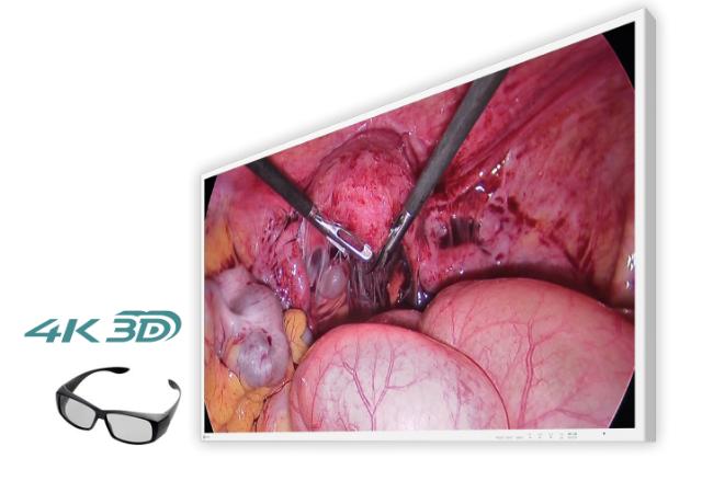 EIZO 43