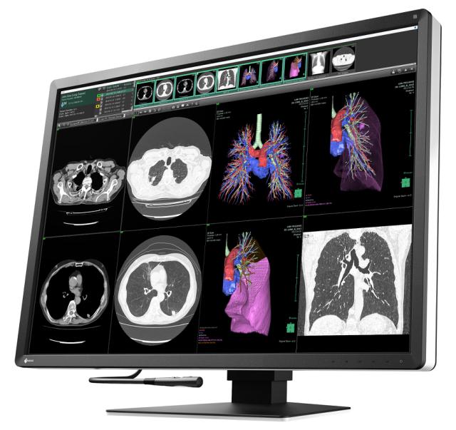 Eizo Radiforce 12mp diagnostisk monitor