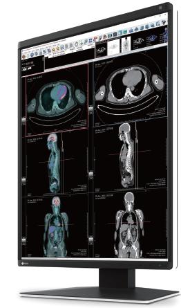 Eizo 3MP diagnostic color monitor