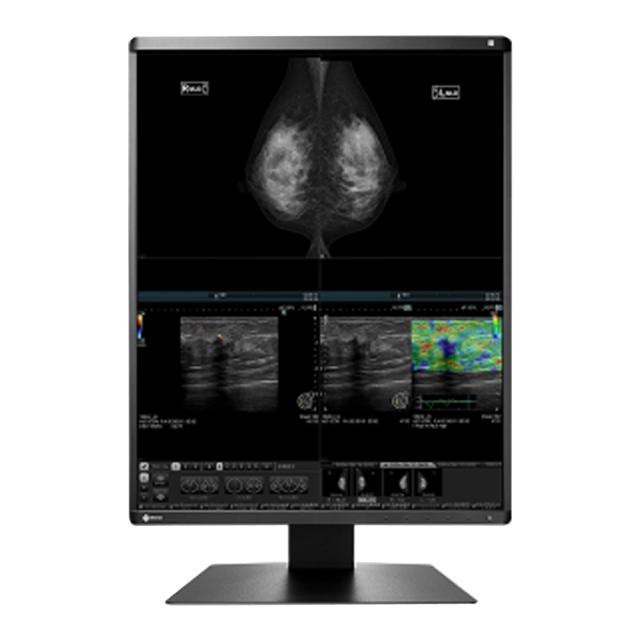 Eizo Mammo Color 21,3