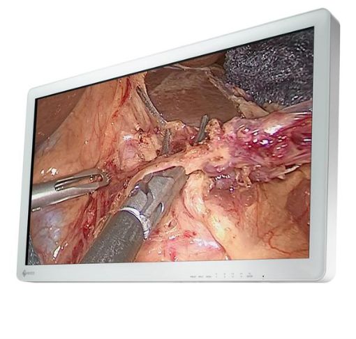 Billede af EIZO 31,5'' FHD CuratOR 2D endoskopimonitor