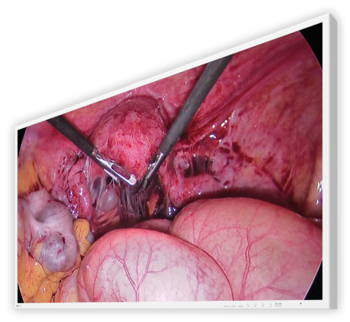 Billede af EIZO 43'' 4K UHD CuratOR 3D endoskopimonitor