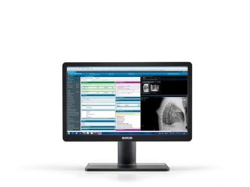 Billede af BARCO 22'' EONIS MDRC-2422 SNIB medical monitor - black
