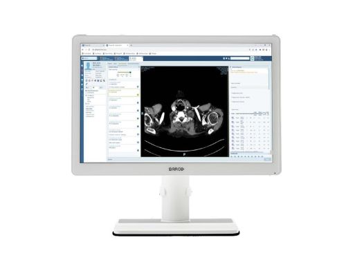 Billede af BARCO 24'' EONIS MDRC-2424 HPEW medical monitor - white