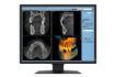 Billede af EIZO 21'' RadiForce MX217, Black, 2MP Color