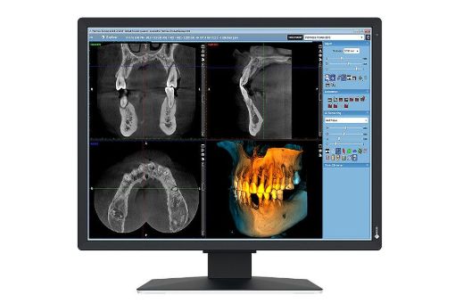 Billede af EIZO 21'' RadiForce MX217, Black, 2MP Color