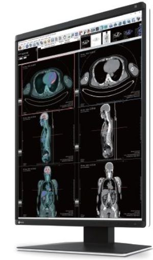 Billede af EIZO 3MP 21,3'' diagnostic color monitor